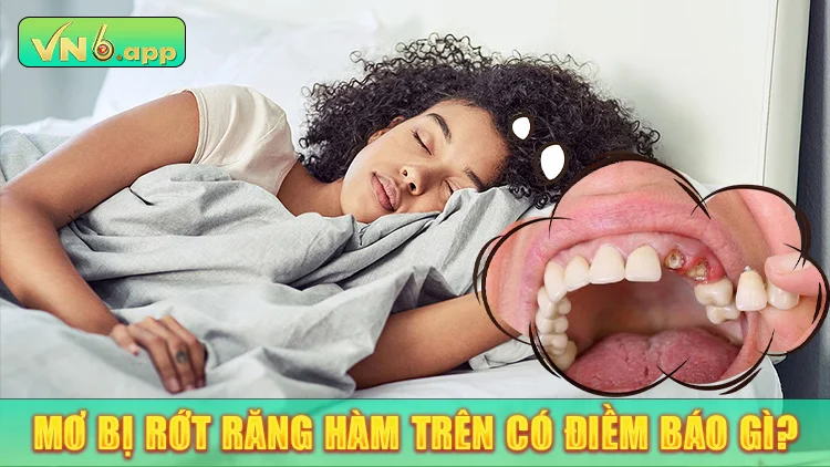 Chiêm bao bị rớt răng hàm trên có điềm báo gì?